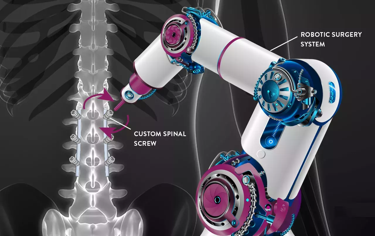 Hitec spinal screw sensor working with robotic surgery arm